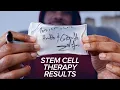 Real Results After BioXcellerator Stem Cell Therapy