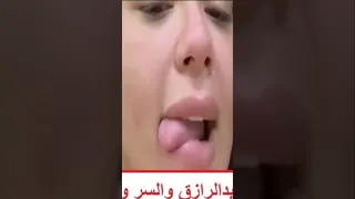 هدير عبد الرازق واوتاكا 18 