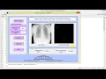 Image Compression using Improved SPIHT Matlab Project Code