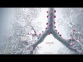EBUS guide for patients bronchoscopy technique for chest abnormalities