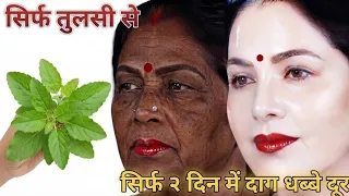 Skin Whitening, Remove Wrinkles Permanently & Dark Spots, From First Use