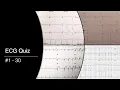 ECG Quiz - 30