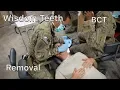 Getting Your Teeth Pulled In Basic Training Four Day Weekends ARMY VLOG
