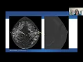 Contrast-enhanced mammography in the BI-RADS manual