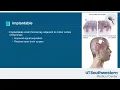 Download Lagu Brain Computer Interface in Patients with ALS