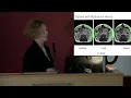 AI Medical Image Analysis Kathleen Curran