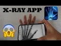 Download Lagu X-Ray App