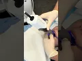 Quick Dental Scan for Retainer Fitting