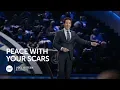 Download Lagu Joel Osteen - Peace With Your Scars