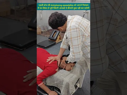 Treatment of Ankylosing spondylitis. #ankylosingspondylitis #reels #ytshorts #delhi #shorts