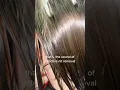 Download Lagu How to remove nits (lice eggs) #piojos #lice #howtogetridoflice