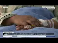 Women s Month Free breast reduction surgery to change lives