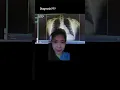 Diagnosis Unremarkable chest findings