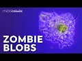 Amoebas Occasional Brain-Eaters