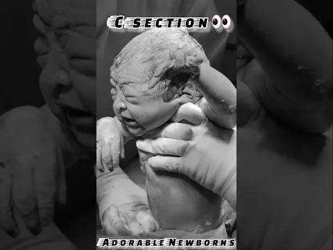 ๐ฅน A Babyโs First Cry, Then Mommyโs Loving Embrace โค๏ธ๐ถ #shorts #baby #mom #family