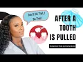 Speed Up Healing After a Tooth Extraction tooth pulled Dentist s 2025 Must-Know Tips