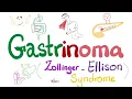 Zollinger-Ellison Syndrome ZES - Gastrinoma