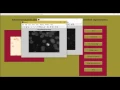 Radon transform for watershed segmentation matlab projects