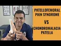 Download Lagu Chondromalacia Patella vs Patellofemoral Pain Syndrome