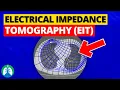 Electrical Impedance Tomography (EIT) | Quick Explainer Video