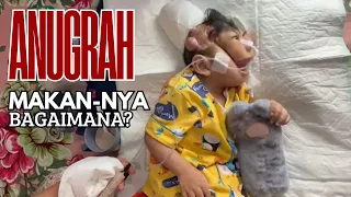 anugrah makan nya bagaimana anugraharshaka anakistimewa anilestariofficial 