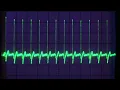 Fun with ECG from an at-home hobbyist perspective exploring waveforms and understanding