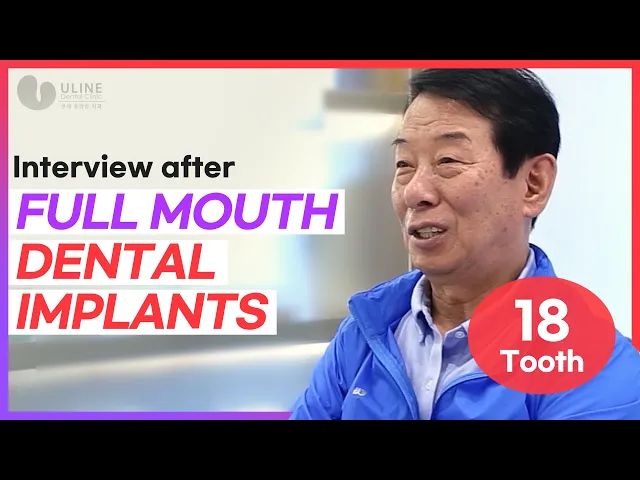 Interview after Full Mouth Dental Implants