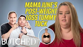 Mama June LOSES 150 lbs Wants a Tummy Tuck Botched E