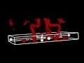Download Lagu Computer-aided Optimal Imaging Plane Prescription for Blood Flow Imaging by MRI
