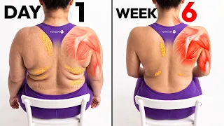 Back Fat + Pain Relief at Home | Low Impact Seated Neck and Spine Exercises for Beginners