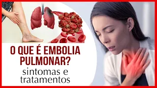 O que é Embolia Pulmonar? Sintomas e Tratamentos.