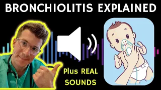 Download Doctor explains Bronchiolitis (RSV) with example of REAL SOUNDS | Respiratory syncytial virus MP3