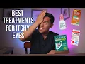 How to Treat Itchy Eyes Top 5 BEST Itchy Eye Treatments Explained by an MD