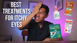 كيفية علاج حكة العين  أفضل   علاجات لحكة العين يشرحها طبيب مختص دندنها