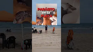 ¡NUNCA en la PLAYA! Descalzos 🥹♥️ más en IG #medicina #curiosidades #sabiasque