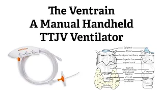Introducing the Ventrain, a manually operated front of neck access ventilator