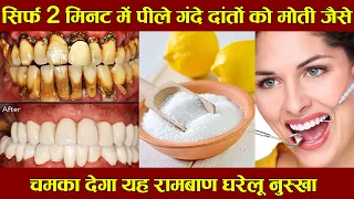 सिर्फ 2 मिनट में पीले गंदे दांतों को मोती की तरह चमका देगा यह नुस्खा - Teeth whitening remedy