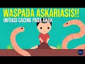 Download Lagu Waspada Askariasis, Infeksi Cacing yang Tidak Terdeteksi!