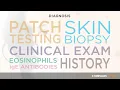 Atopic Dermatitis - Risk Factors Symptoms and Diagnosis