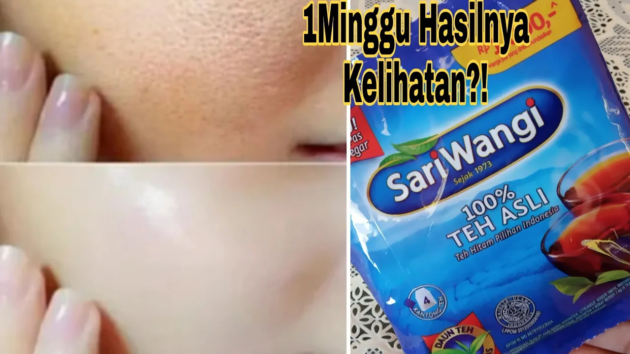 Rajin Cuci Muka Tapi Masih Dekil? Ini Yang Harus Lu Tau!!. 