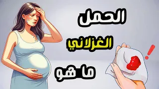 ما هو الحمل الغزلاني 