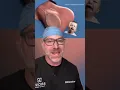 How Do You Reverse a Vasectomy