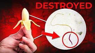how to do recovery all boys need to watch this video 