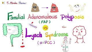 FAP vs Lynch Familial Adenomatous Polyposis vs Hereditary Nonpolyposis Colorectal cancer -Oncology