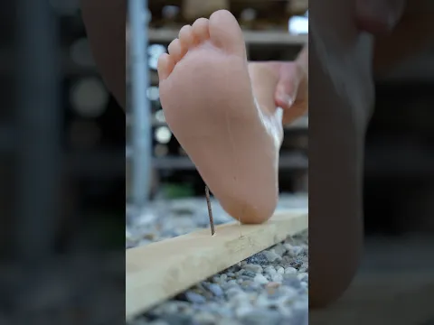 STEPPED ON A NAIL? DON’T JUST COVER IT! 🦶🔩 #ambulance #paramedic #emergency #firstaid #lifehacks