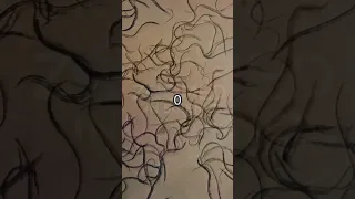 Bleach vs parasites under the microscope See the action