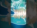 Impacted Wisdom Teeth Explained