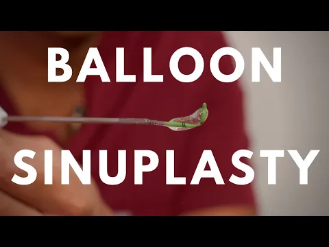 Download MP3 What is a Balloon Sinuplasty?  Do I Need Sinus Surgery / ENT Houston