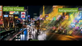What Is Astigmatism Explained by an Eye Doctor