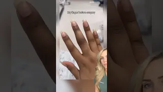 تعليق طبيب  بتر الإصبع   دندنها